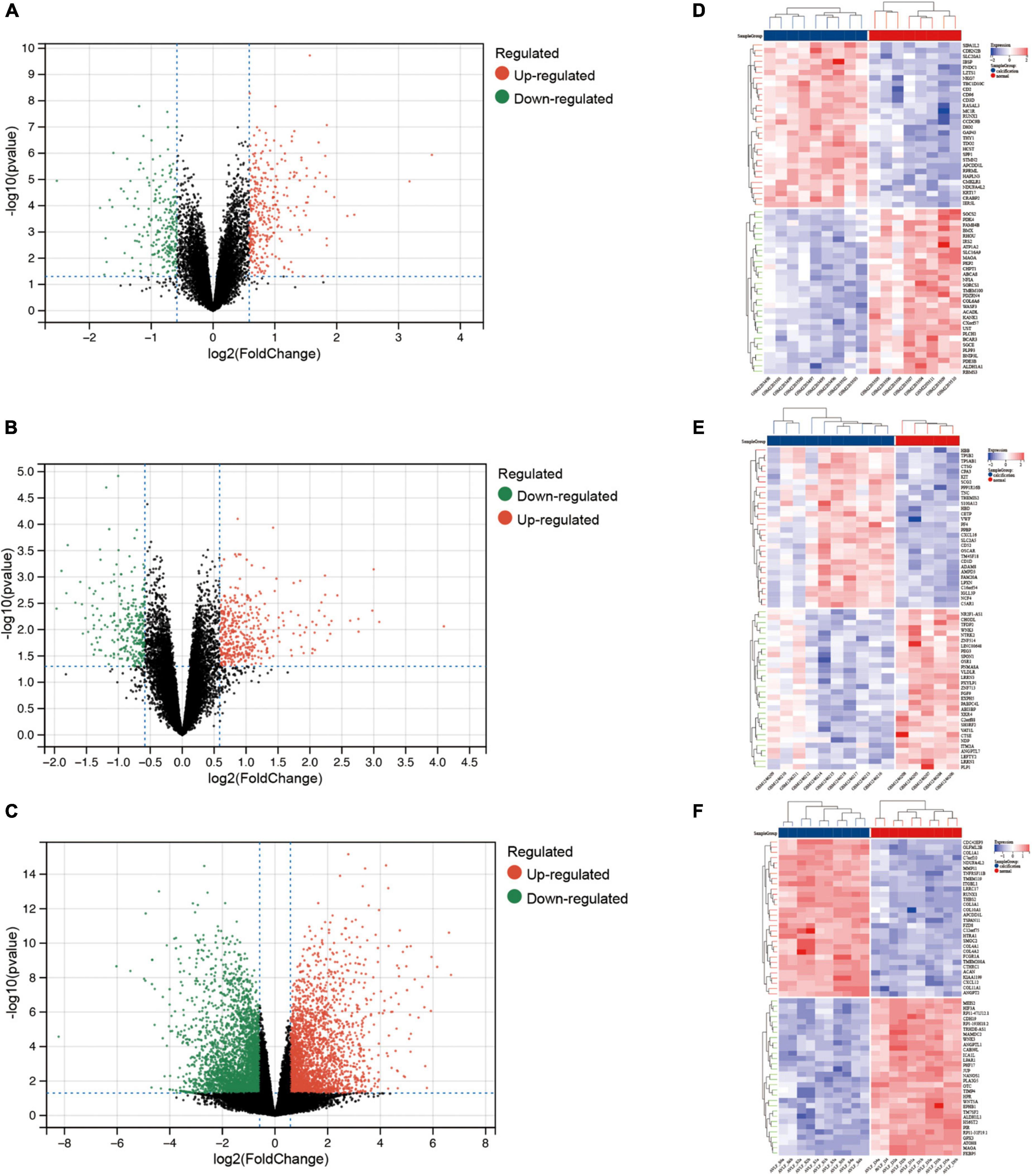 Exploration and validation of the influence of angiogenesis-related factors in aortic valve calcification